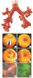 “康为医疗”CLA9/8荧光气管支气管树模型(消化内科技能模型）