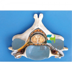 “康为医疗”第五颈椎附脊髓和脊神经放大模型