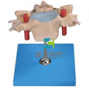 “康为医疗”颈椎附脊髓和脊神经放大模型