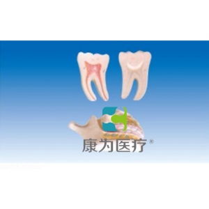 “康为医疗”牙列与磨齿模型
