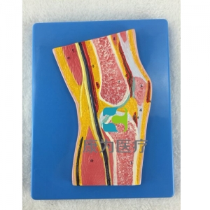 “康为医疗“膝关节剖面模型