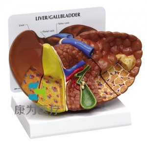 “康为医疗”医患关系沟通模型-异常肝脏模型 （医学指导模型）