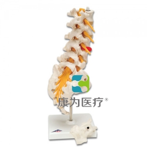 腰脊柱，有脊外侧椎间盘脱出