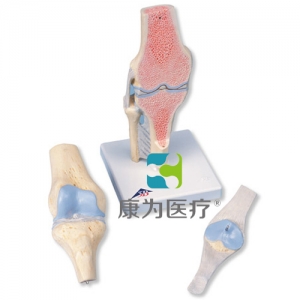膝关节截面模型，3部分