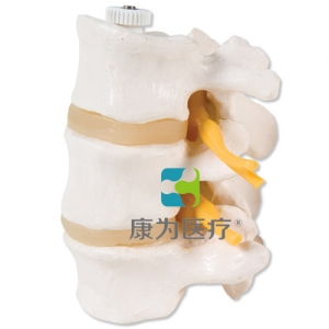 活动安装3块腰椎