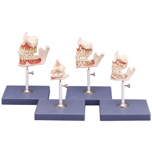 牙齿发育模型