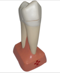 上颌两根龋齿模型
