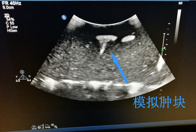 超声引导下颈部体表肿块活检模块