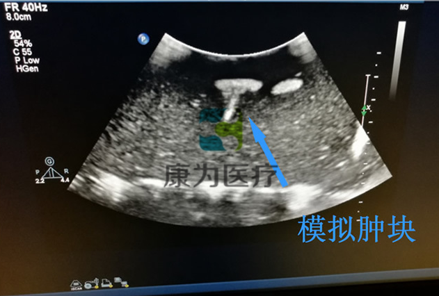 超声引导下四肢血管活检模块