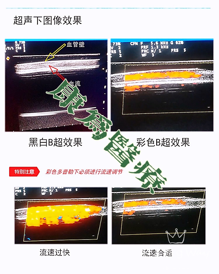 “康为医疗”超声引导下血管穿刺训练模块